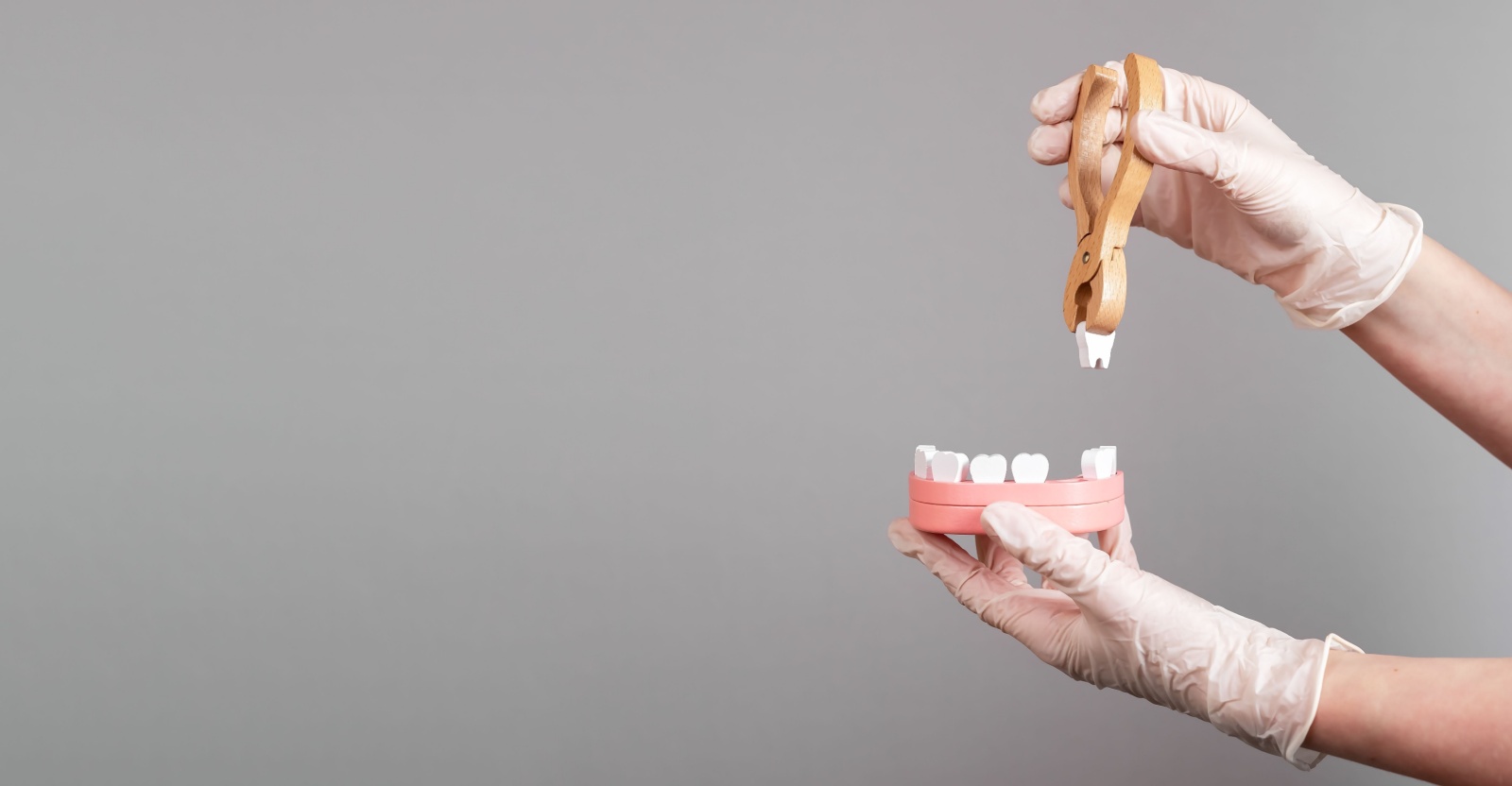 Ladson Tooth Extractions