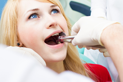  Tooth Extractions in Ladson